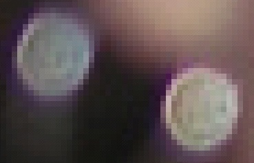 Two magnified point sources below the woman's ear