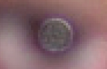 Magnified point source in the man's eye